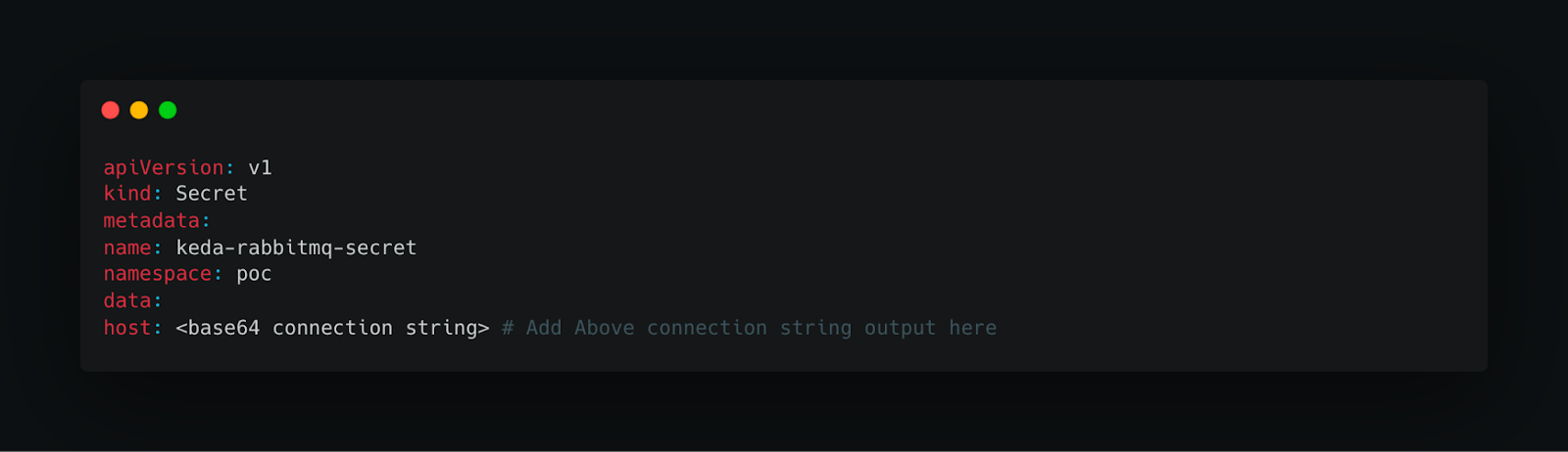 secret-connection-string